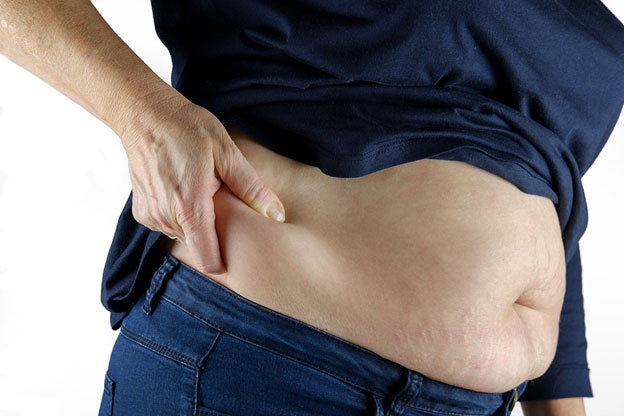 You-Don't-Need-to-Exercise-After-a-Tummy-Tuck